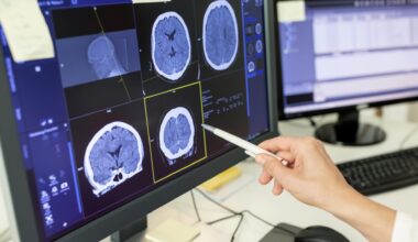How smart choices and quicker response can outsmart stroke