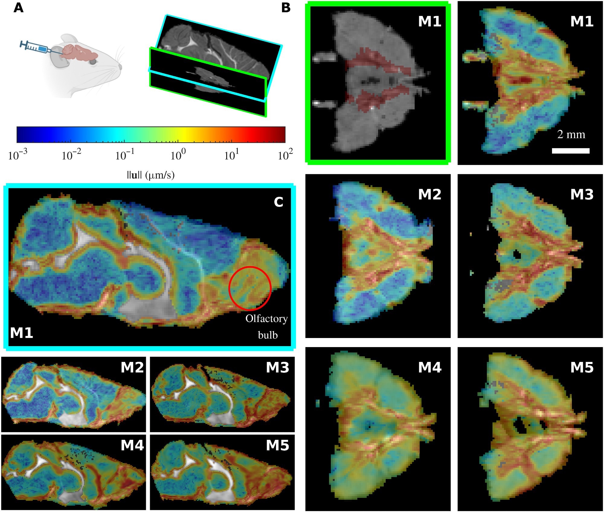 The MR-AIV inferred velocity magnitude is similar across mice. (A) Gadobutrol is infused into the cisterna magna of five mice (M1 to M5), and the tracer movement is recorded via DCE-MRI. (B) The Circle of Willis (location marked in red on the M1 structural image at top left) can be seen in the transverse plane. Flow is consistently fast near the Circle of Willis and the olfactory bulb, which can be observed in the midsagittal plane. Velocity fields are overlaid on grayscale structural MRI images, which show through in excluded regions. The velocity magnitudes are similar for the five mice. (C) The MR-AIV–inferred velocity magnitude in two planes (midsagittal, left; transverse plane, right).