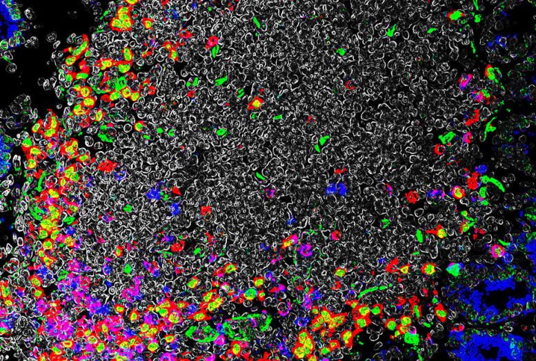 Immune Cell Aggregates in the Intestine
