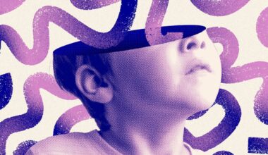 Brain scans reveal 3 ADHD subtypes, including a more extreme form