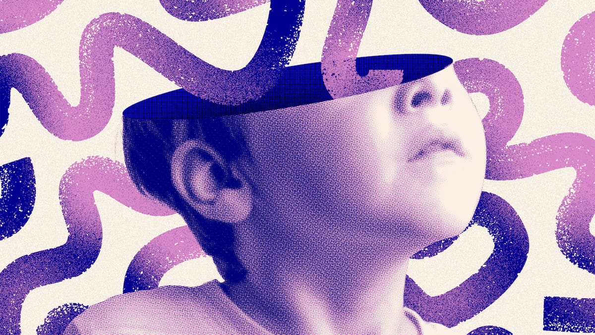 Brain scans reveal 3 ADHD subtypes, including a more extreme form
