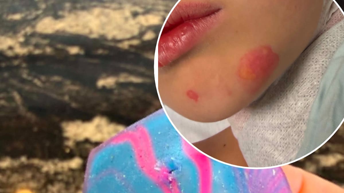 Tiktok trend warning: New Zealand boy, 8, suffers burns after microwaving squishy toy