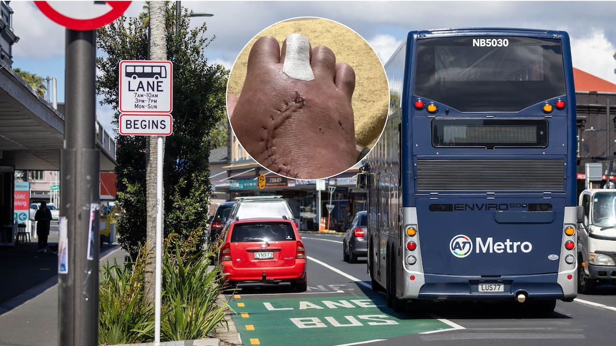 Man run over by bus in hit-and-run says Auckland Transport offered him $20 Hop card