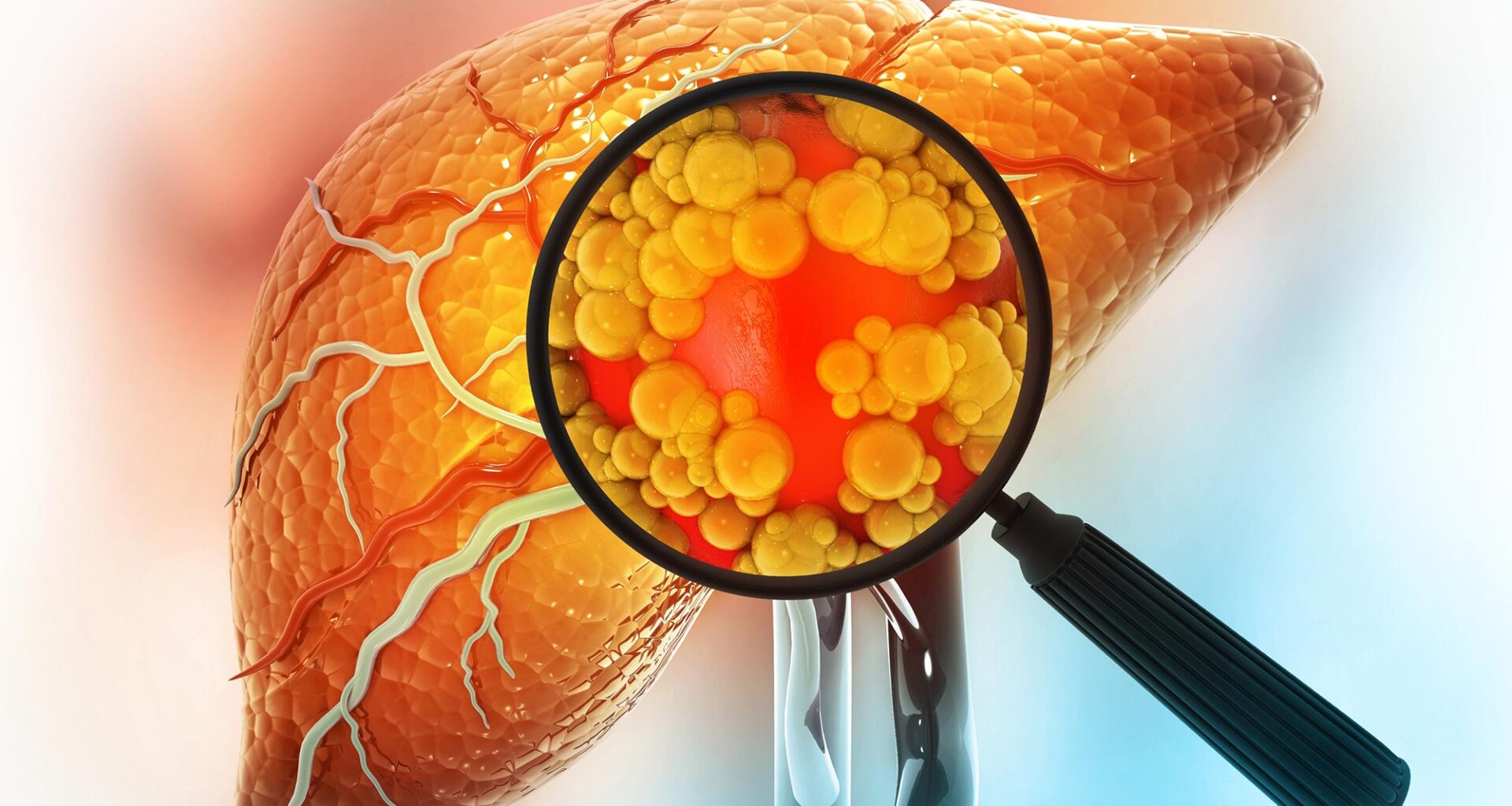 Magnifying Glass Showing Diseased Liver