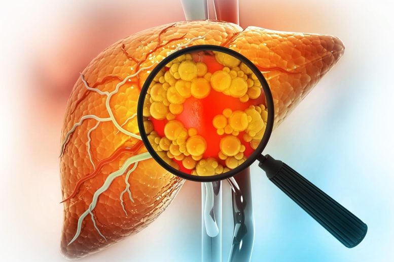Magnifying Glass Showing Diseased Liver