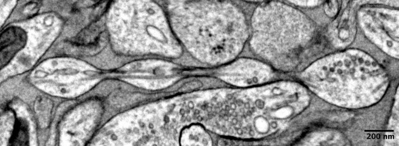 Pearling Structure of an Axon