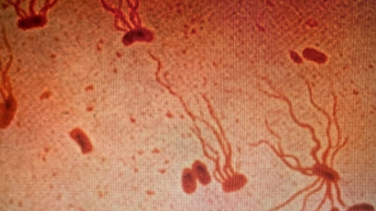 Ancient Killer Is Rapidly Gaining Resistance to Antibiotics, Study Warns : ScienceAlert
