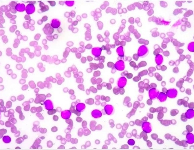 Common anemia drugs may help slow cancer growth and progression