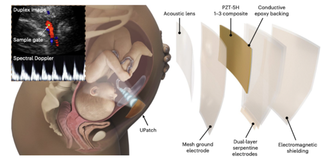 New Ultrasound Patch Could 
