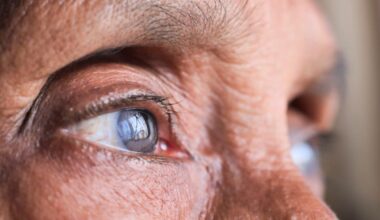 Why More Eye Specialists Are Recommending Supplements For Better Vision Health