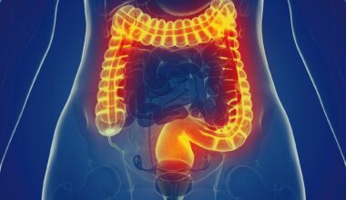 Woman Large Intestine Anatomy Front