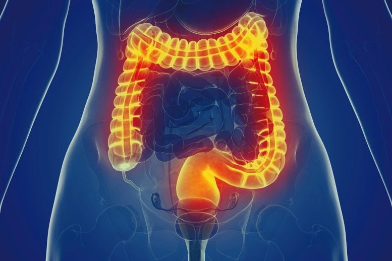 Woman Large Intestine Anatomy Front