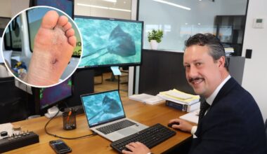 Prosecutor Tobias Taane’s months-long recovery after stingray barb at Pāpāmoa beach