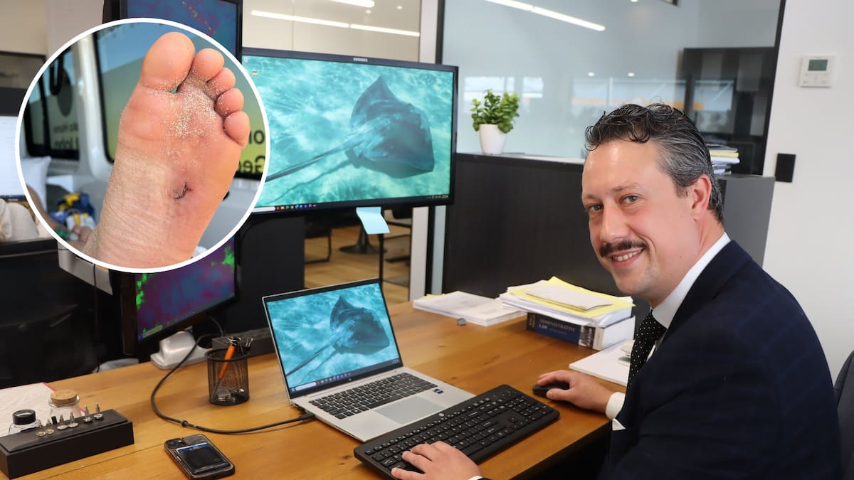 Prosecutor Tobias Taane’s months-long recovery after stingray barb at Pāpāmoa beach