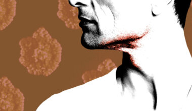 Doctors trace rare animal disease in sexual networks of gay men