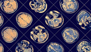 Simple amino acid supplement may help fight Alzheimer’s disease