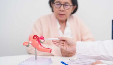 PCOS gets new name in hopes of improving diagnosis, care