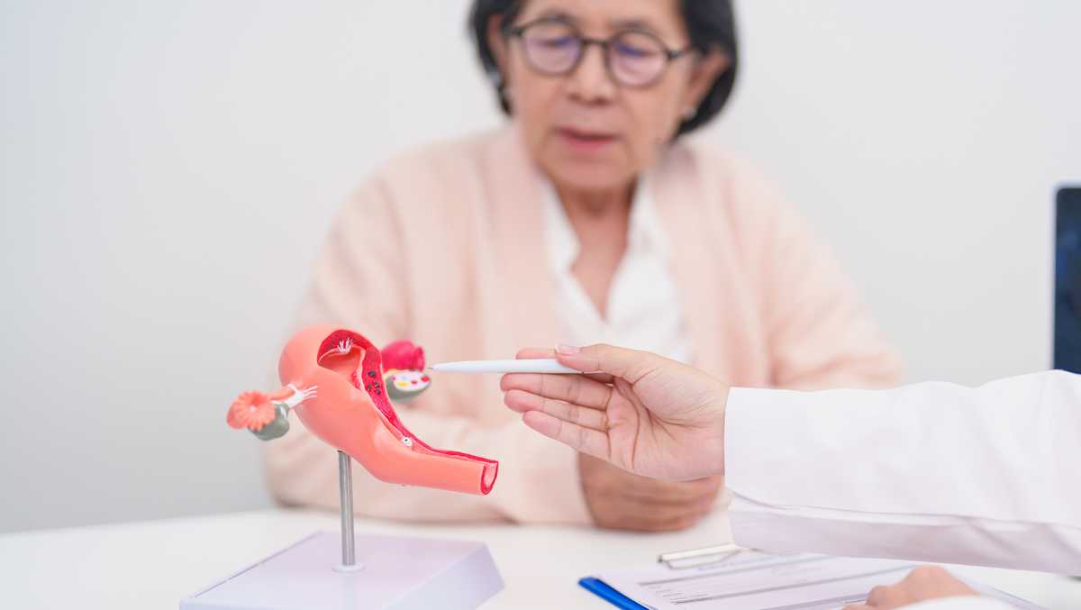 PCOS gets new name in hopes of improving diagnosis, care