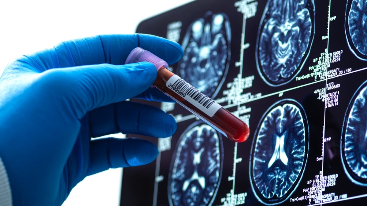 Some Signs of Depression May Show Up in Blood, Study Finds : ScienceAlert