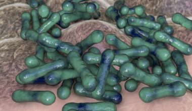 Australia’s deadly disease outbreak linked to waning vaccinations
