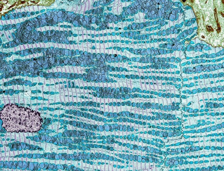 A coloured microscopy image of a heart muscle cell showing multiple rows of elongated mitochondria in blue, arranged between parallel bands of light blue myofilament proteins