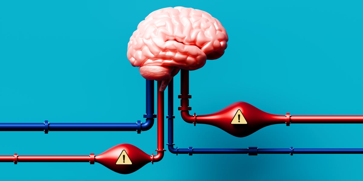 Why Women Face Unique Stroke Risks—and How to Prevent Them