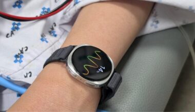 A Galaxy watch on an arm of someone in a hospital bed, showing wavy lines.