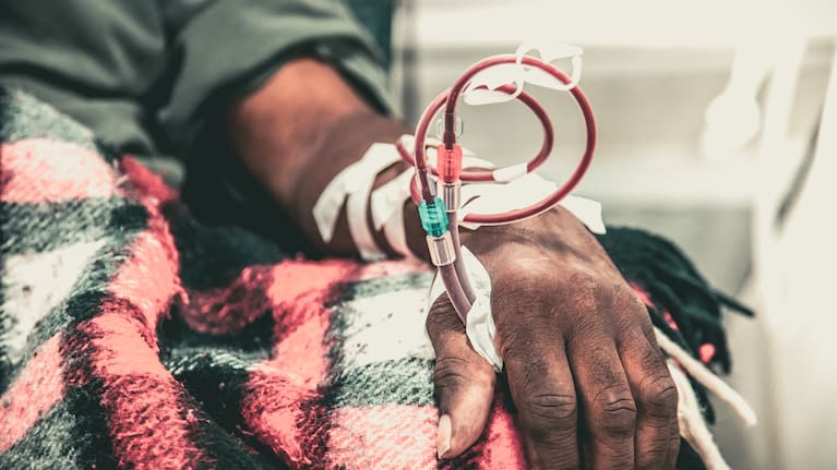Person on dialysis.