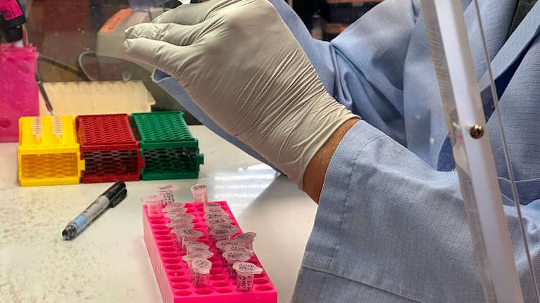 Research scientist Robert Nofchissey prepares samples of inactivated material as part of hantavirus research at the Center for Global Health at the University of New Mexico Health Sciences Center in Albuquerque, New Mexico, on Monday, May 4, 2026