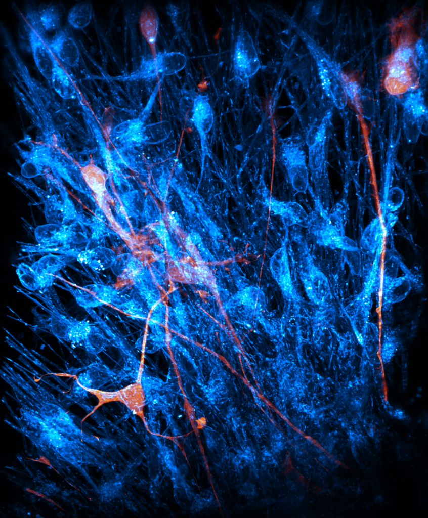 blue and orange stained cells against a black background