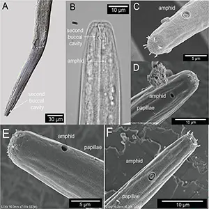 Terminal head region of the new animal species found in the Great Salt Lake, Diplolaimelloides woaabi sp. nov. Credit: University of Utah
