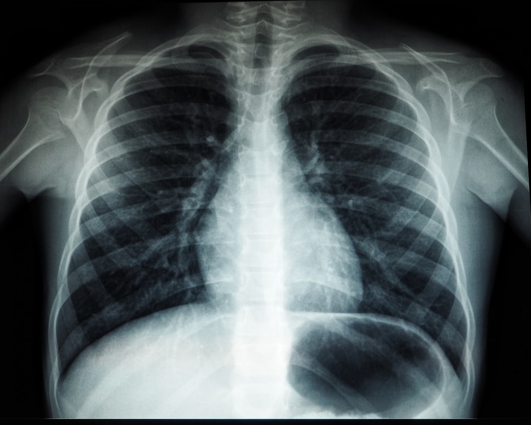 How AI Could Help Cure Pancreatic Cancer