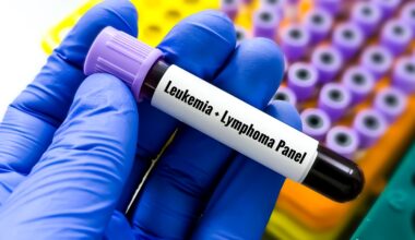 Early forever chemicals exposure linked to higher lymphoblastic leukaemia risk in children