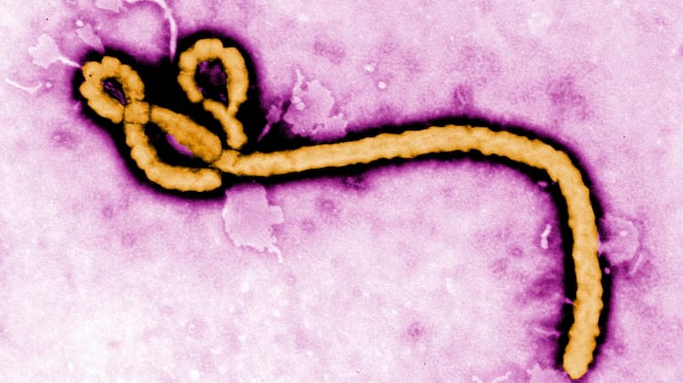 This undated colorized transmission electron micrograph file image made available by the Centers for Disease Control and Prevention (CDC) shows an Ebola virus virion.