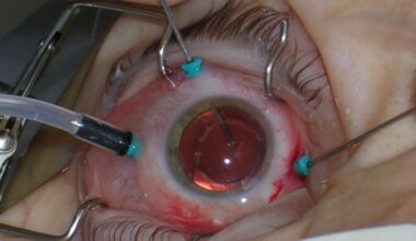 Eye to Eye: quizzing Drs Peter Hadden and Sophie Hill