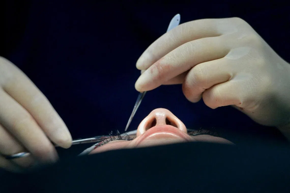 This photo taken on May 21, 2024 shows a doctor conducting cosmetic eyelid surgery on a patient at a hospital in Shenyang, in northeastern China’s Liaoning province.