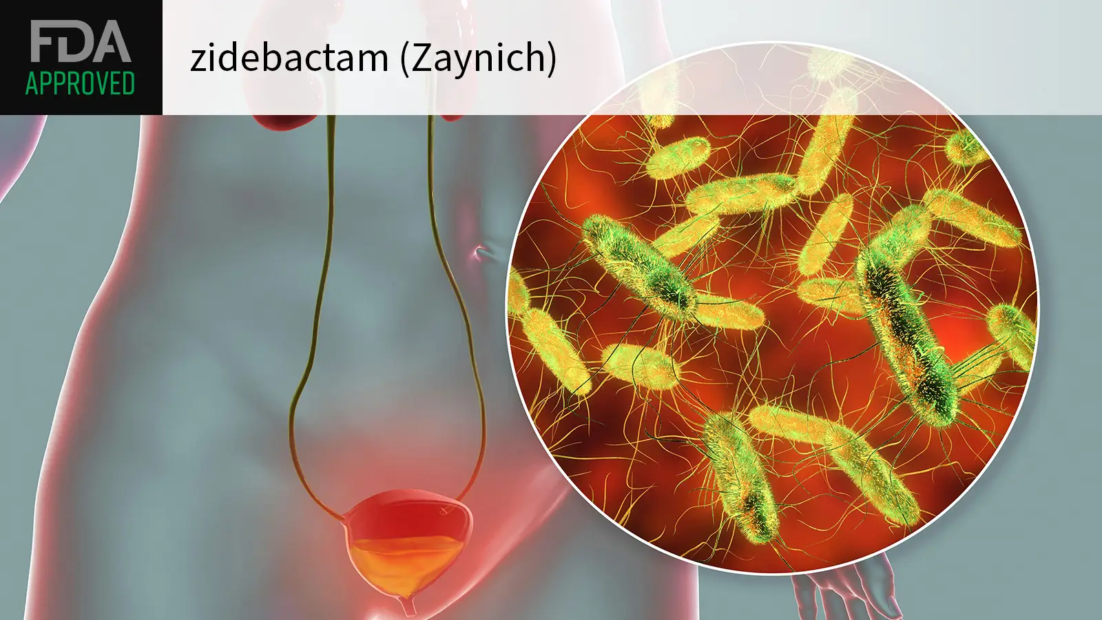 FDA APPROVED zidebactam (Zaynich) over a computer rendering of a urinary tract infection.