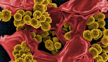 A scanning electron microscope image of Staphylococcus aureus and a dead human neutrophil.