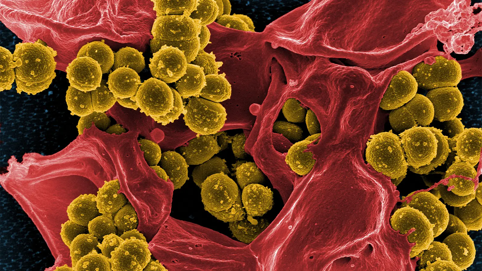 A scanning electron microscope image of Staphylococcus aureus and a dead human neutrophil.