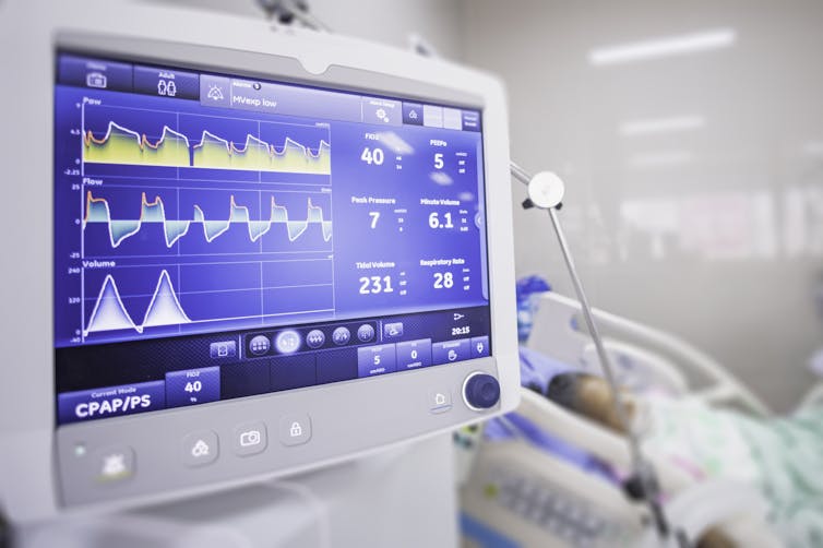 A ventilator connected to a patient shows vital readings on a blue screen in a hospital room.