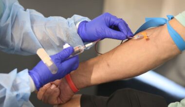 New blood test detects aggressive prostate cancer more accurately than PSA, study finds