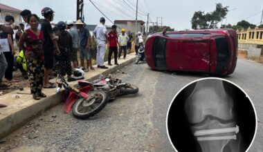 Auckland man still recovering a year after Vietnam motorbike crash where car ‘flew through air’