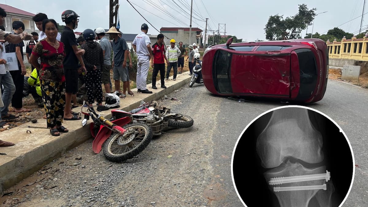 Auckland man still recovering a year after Vietnam motorbike crash where car ‘flew through air’