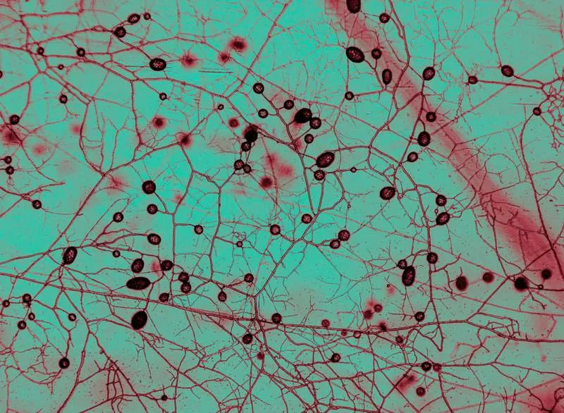 Mycorrizhal fungi under the microscope at AMOLF biophysics institute in Amsterdam. The circular structures are spores. Color is altered for legibility. (CREDIT: Tomás Munita)