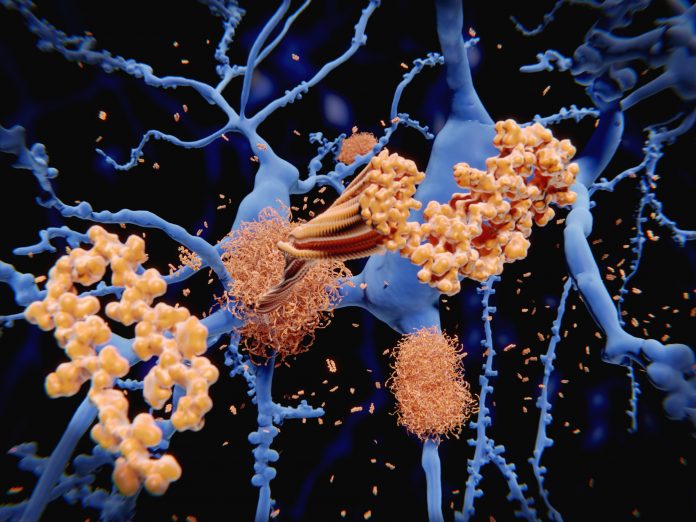 Alzheimer's disease: illustration of the amyloid-beta 40 peptide (and others) accumulating to form amyloid fibrils that build up dense amyloid plaques. CD2AP.