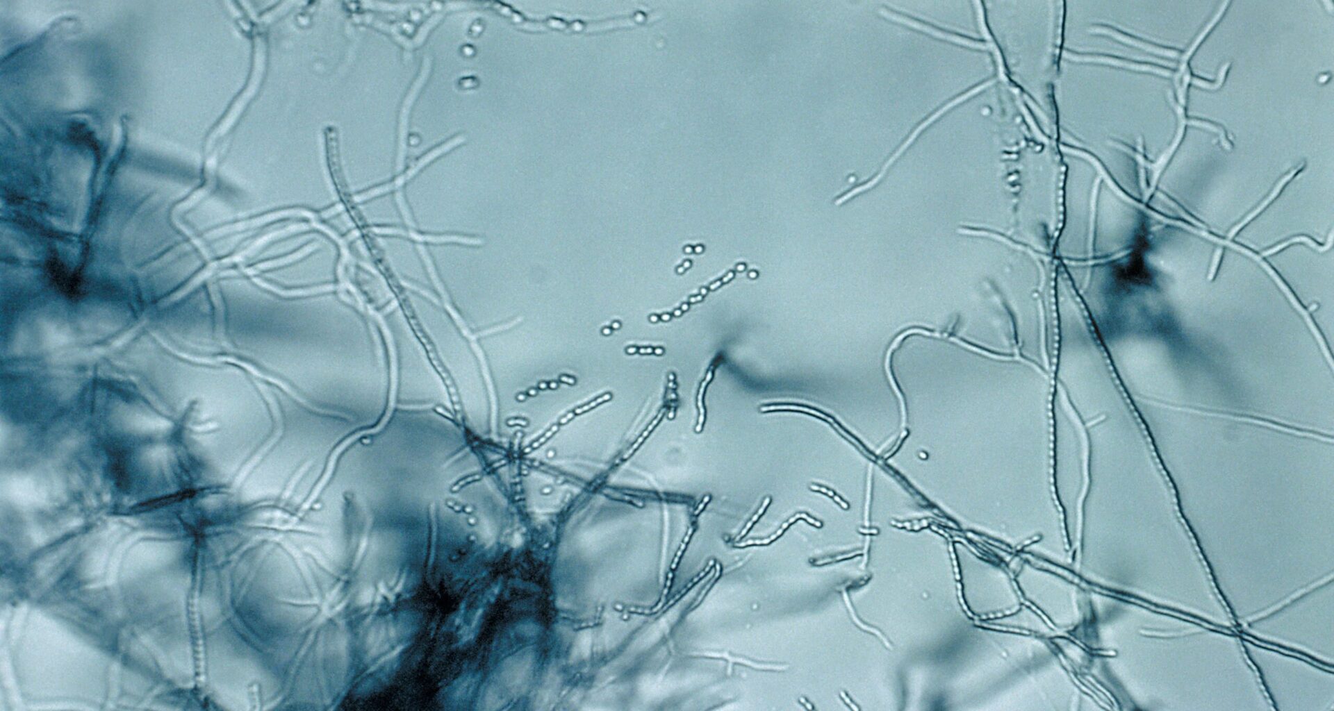 Antibiotic "megacluster" discovery provides new strategy to fight superbugs