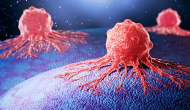 Kinase Droplets Activate Growth Signals, Path for Cancer Therapy