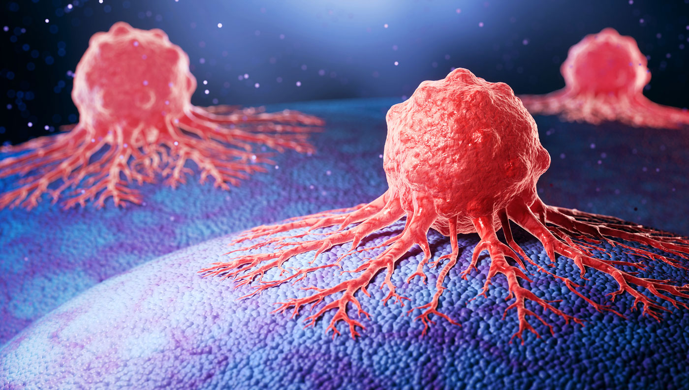 Kinase Droplets Activate Growth Signals, Path for Cancer Therapy