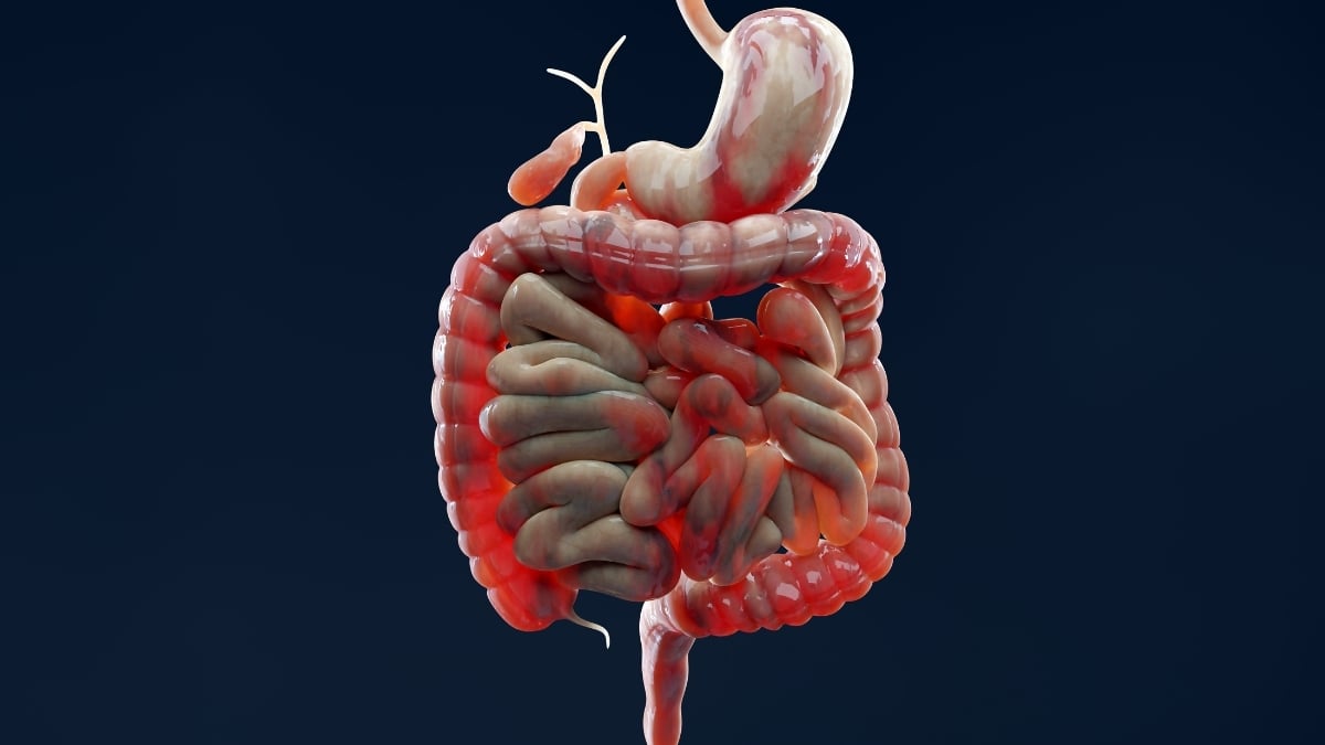 Scientists Solve a 30-Year Mystery Behind Inflammatory Bowel Disease : ScienceAlert