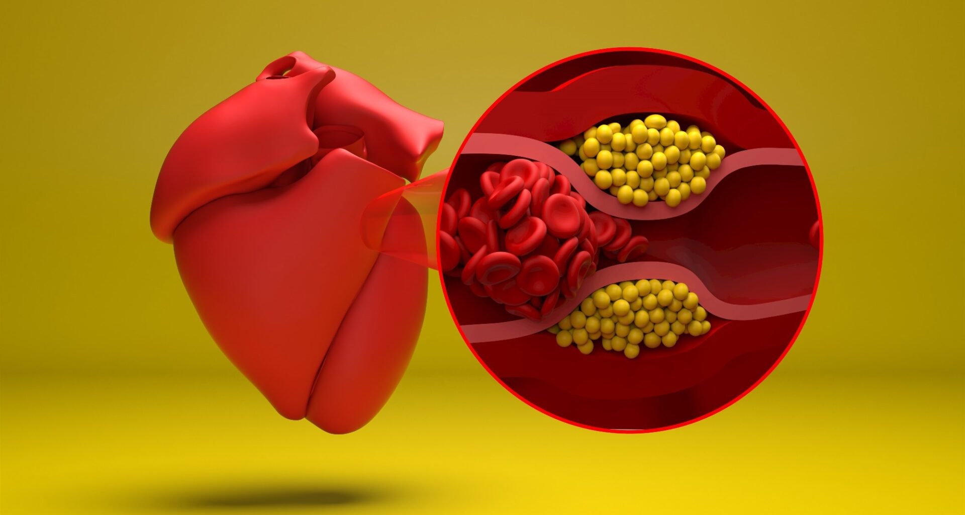 Study: Glucagon‐Like Peptide‐1 Receptor Agonists and Cardiovascular Events in Adults With Obesity and Autoimmune Disease: A Target Trial Emulation. Image Credit: Nemes Laszlo / Shutterstock